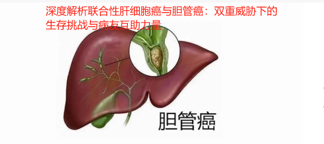 深度解析联合性肝细胞癌与胆管癌：双重威胁下的生存挑战与病友互助力量