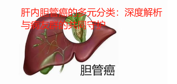 肝内胆管癌的多元分类：深度解析与病友群的共同守护