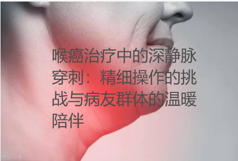 喉癌治疗中的深静脉穿刺：精细操作的挑战与病友群体的温暖陪伴