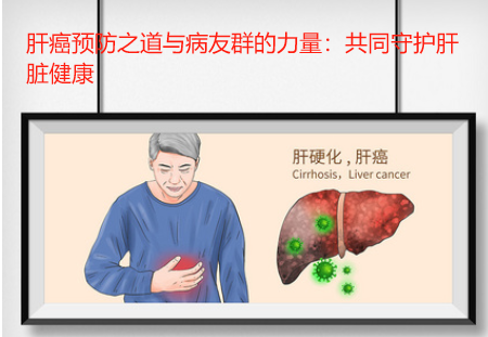 肝癌预防之道与病友群的力量：共同守护肝脏健康