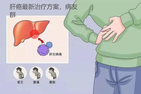 肝癌的最新治疗方案主要包括以下几种：