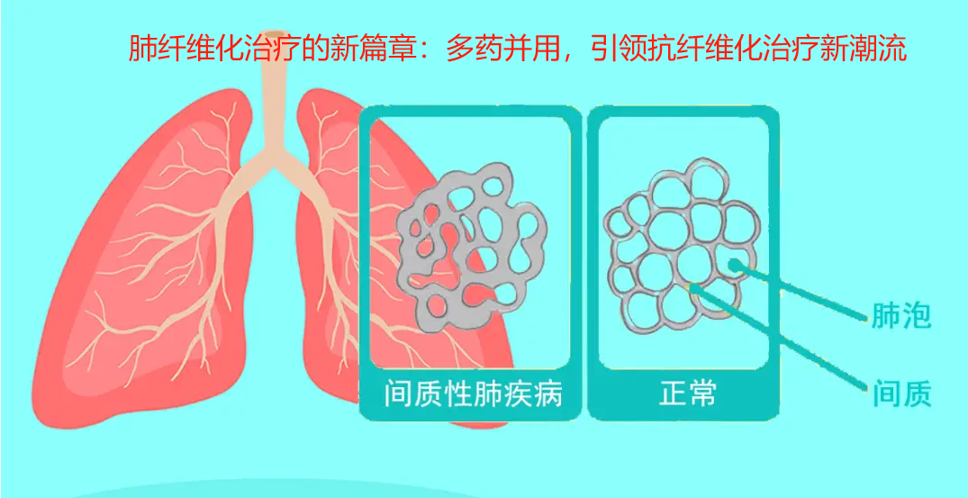 这3类人易高发鼻咽癌！关于鼻咽癌，这4点要听进去！