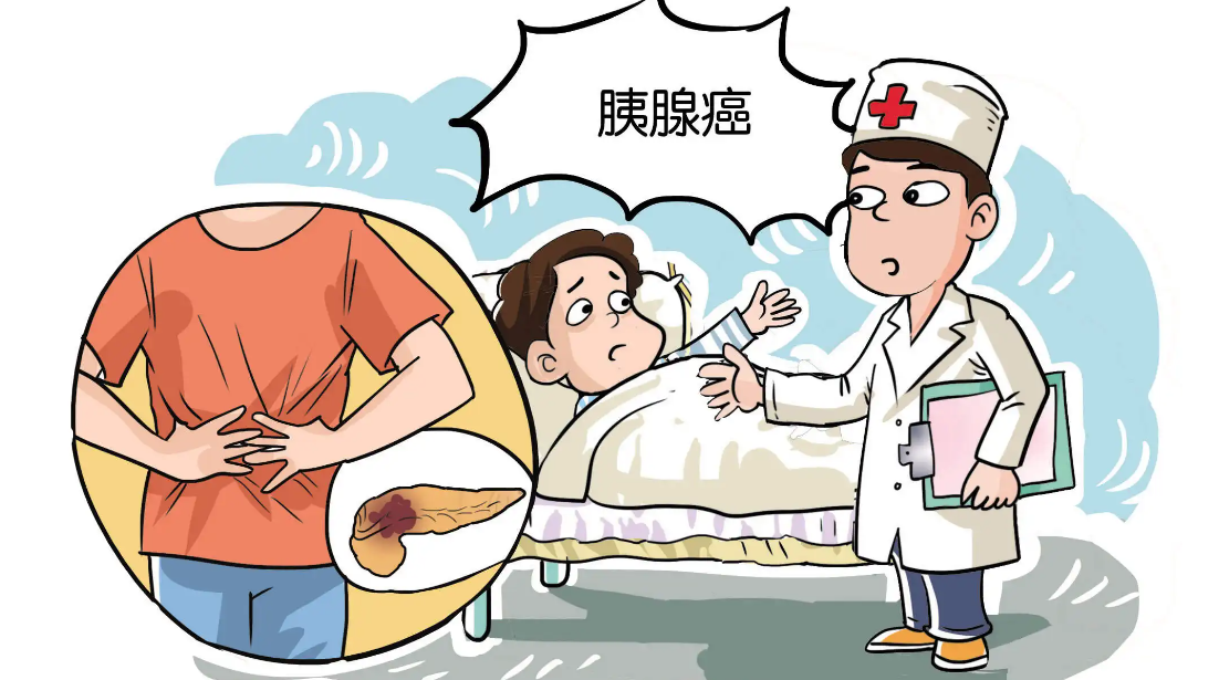 胰腺癌目前哪个治疗方案更好
？病友群