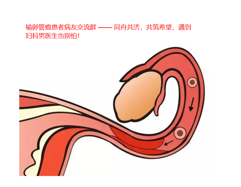 巴彦淖尔输卵管癌患者病友交流群 —— 同舟共济，