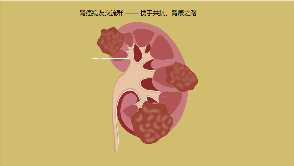 奉节肾癌病友交流群 —— 携手共抗，肾康之路