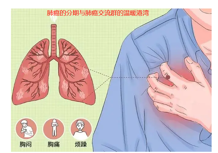 菏泽肺癌的分期与肺癌交流群的温暖港湾